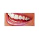 Pachet promo 15 x Skyce Crystal Refill 1.8mm bijuterie dentara Ivoclar